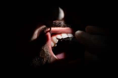 igiene-dentale-1
